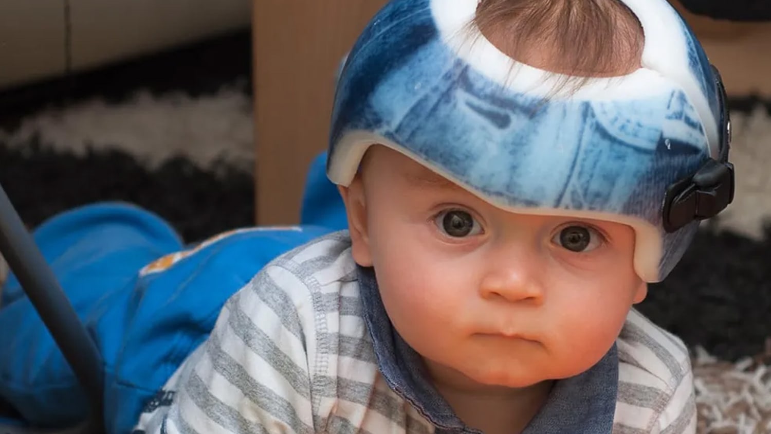 Head shaping helmets infant newborn helmet therapy to shape head