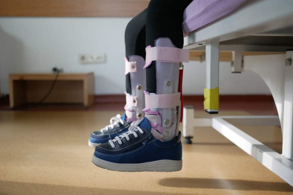 Child wearing ankle-foot orthoses (AFOs) with supportive shoes to help improve walking stability and lower limb alignment.